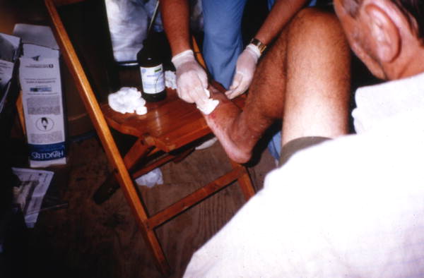 Hurricane Andrew victim receiving aid inside a tent city set up in Dade County, Florida.