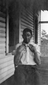 Smallpox patient at an isolation hospital in Hillsborough County, Florida.