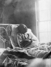 View of a smallpox patient.